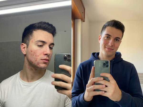 Before After